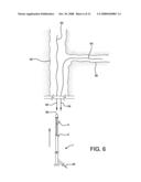 Catheter Having Guidewire Channel diagram and image