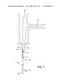 Catheter Having Guidewire Channel diagram and image