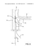 Catheter Having Guidewire Channel diagram and image