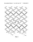 Intraluminal Stent, Delivery System, and Method of Treating a Vascular Condition diagram and image