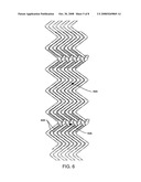 Intraluminal Stent, Delivery System, and Method of Treating a Vascular Condition diagram and image