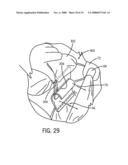 Infant sleeping apparatus and child containment system diagram and image