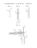 Fly Fishing Method and Apparatus diagram and image