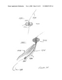 Fly Fishing Method and Apparatus diagram and image