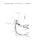 Patient Ventilating And Aspirating System diagram and image