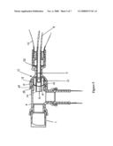 Patient Ventilating And Aspirating System diagram and image