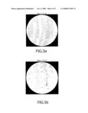 X-Ray Detector With Correction for Scattered Radiation diagram and image