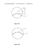 Multifocal Lens Having a Progressive Optical Power Region and a Discontinuity diagram and image