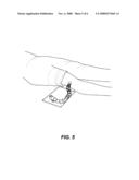 Adjustable Radiographic Marker and Calibration Aid diagram and image