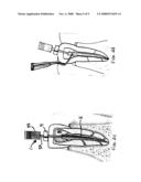 Dental device for use in the obturation of a root canal diagram and image