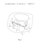 Co-Sequence Interference Detection and Treatment diagram and image