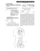 Implantable heart assist system and method of applying same diagram and image