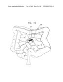 Prolonged Transit Time of Permeability-Enhancing Drug Eluting Pill diagram and image