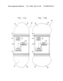 Prolonged Transit Time of Permeability-Enhancing Drug Eluting Pill diagram and image