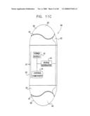 Prolonged Transit Time of Permeability-Enhancing Drug Eluting Pill diagram and image