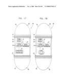 Prolonged Transit Time of Permeability-Enhancing Drug Eluting Pill diagram and image