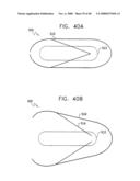 Prolonged Transit Time of Permeability-Enhancing Drug Eluting Pill diagram and image