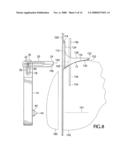 Distal femoral cutting guide diagram and image