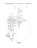 Distal femoral cutting guide diagram and image