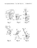 Method and Apparatus for Repairing Separations in the Capsular Labrum Structure diagram and image