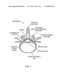 GUIDEWIRE EXCHANGE SYSTEMS TO TREAT SPINAL STENOSIS diagram and image