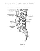 GUIDEWIRE EXCHANGE SYSTEMS TO TREAT SPINAL STENOSIS diagram and image