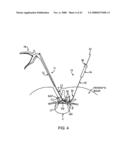 GUIDEWIRE EXCHANGE SYSTEMS TO TREAT SPINAL STENOSIS diagram and image