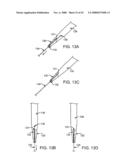 GUIDEWIRE EXCHANGE SYSTEMS TO TREAT SPINAL STENOSIS diagram and image