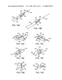 GUIDEWIRE EXCHANGE SYSTEMS TO TREAT SPINAL STENOSIS diagram and image