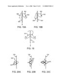 GUIDEWIRE EXCHANGE SYSTEMS TO TREAT SPINAL STENOSIS diagram and image