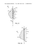 GUIDEWIRE EXCHANGE SYSTEMS TO TREAT SPINAL STENOSIS diagram and image