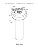 GUIDEWIRE EXCHANGE SYSTEMS TO TREAT SPINAL STENOSIS diagram and image