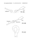 GUIDEWIRE EXCHANGE SYSTEMS TO TREAT SPINAL STENOSIS diagram and image