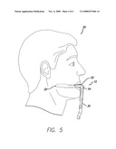 AIRWAY SUCTION SPOON diagram and image