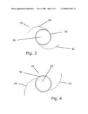 Capsular Ring diagram and image