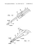 Intracorneal Lens Insertion System diagram and image