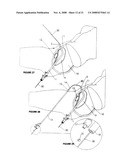 CYSTOTOMY CATHETER CAPTURE DEVICE AND METHODS OF USING SAME diagram and image