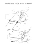 CYSTOTOMY CATHETER CAPTURE DEVICE AND METHODS OF USING SAME diagram and image