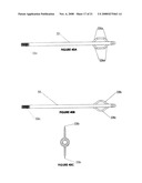 CYSTOTOMY CATHETER CAPTURE DEVICE AND METHODS OF USING SAME diagram and image