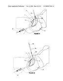 CYSTOTOMY CATHETER CAPTURE DEVICE AND METHODS OF USING SAME diagram and image