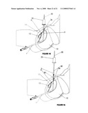 CYSTOTOMY CATHETER CAPTURE DEVICE AND METHODS OF USING SAME diagram and image