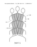 ARTICULATING RETRIEVAL DEVICE diagram and image