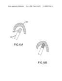 Design of Handle Set for Ablation Catheter with Indicators of Catheter and Tissue Parameters diagram and image