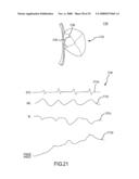 Design of Handle Set for Ablation Catheter with Indicators of Catheter and Tissue Parameters diagram and image