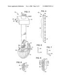 Transoral endoscopic gastroesophageal flap valve restoration device, assembly, system and method diagram and image