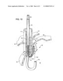 Transoral endoscopic gastroesophageal flap valve restoration device, assembly, system and method diagram and image