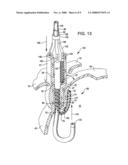 Transoral endoscopic gastroesophageal flap valve restoration device, assembly, system and method diagram and image