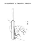 Suture tensioning device diagram and image