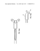 Suture tensioning device diagram and image