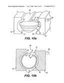 ANASTOMOTIC SEAL LOADING TOOL diagram and image